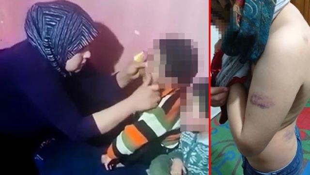 Olmaz olsun böyle anne baba! Çocuklarının ağızlarını bantlayıp çakmakla yaktılar