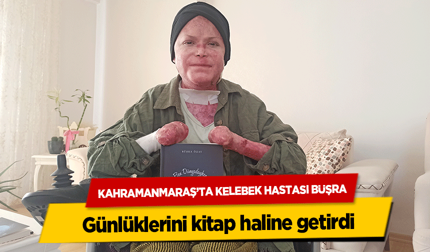 Kahramanmaraş’ta Kelebek Hastası Büşra günlüklerini kitap haline getirdi