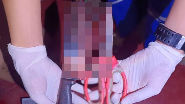 27 yaşındaki rahip, herkesin önünde makasla cinsel organını kesti